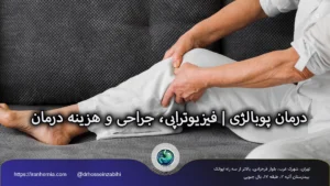 درمان پوبالژی