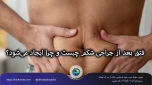 فتق بعد از جراحی شکم چیست و چرا ایجاد می‌شود؟