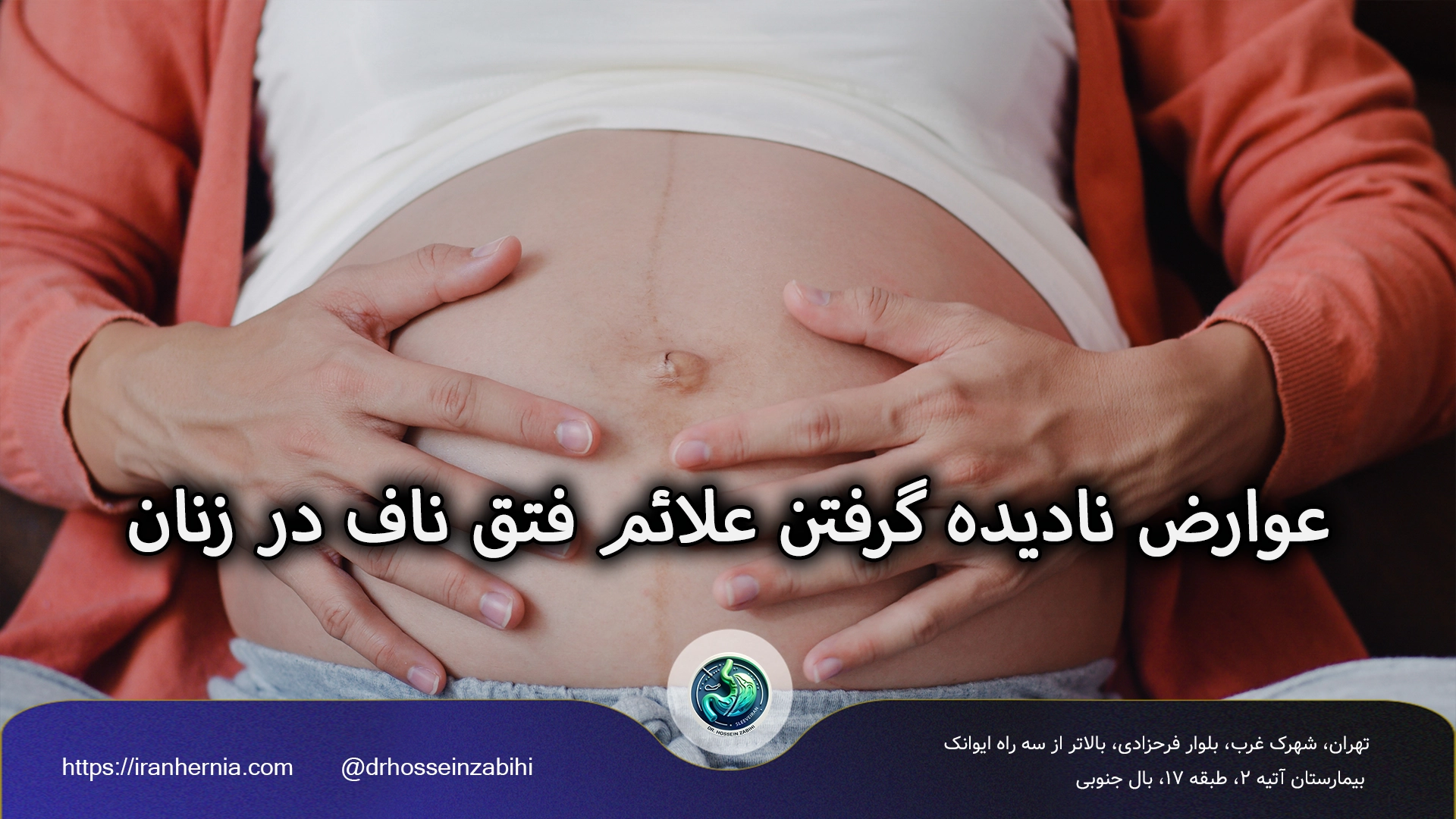 علائم فتق ناف در زنان