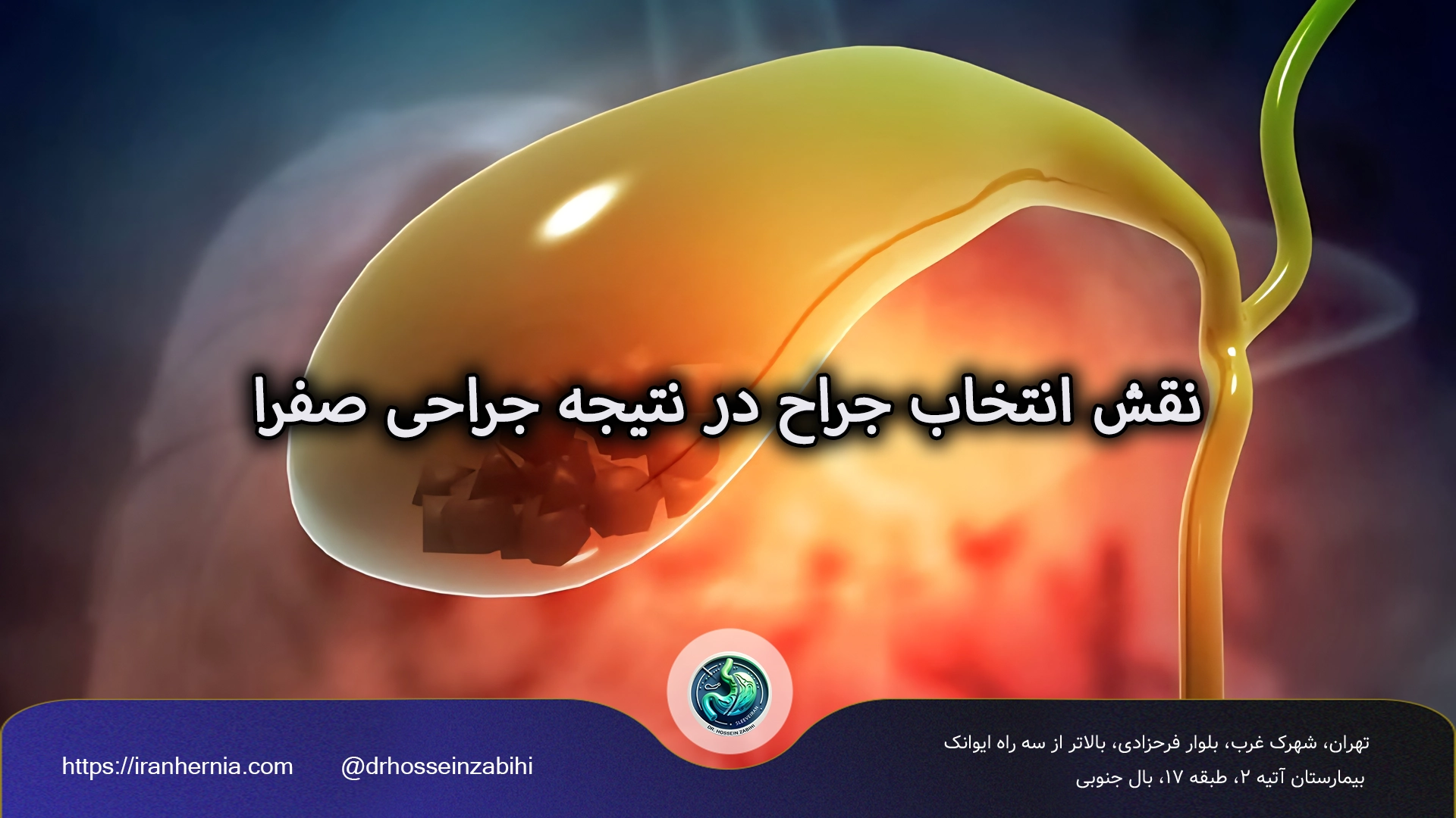 نقش انتخاب جراح در جراحی صفرا