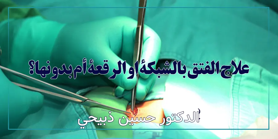 الجراحة بدون شبكة هل هي فعالة؟