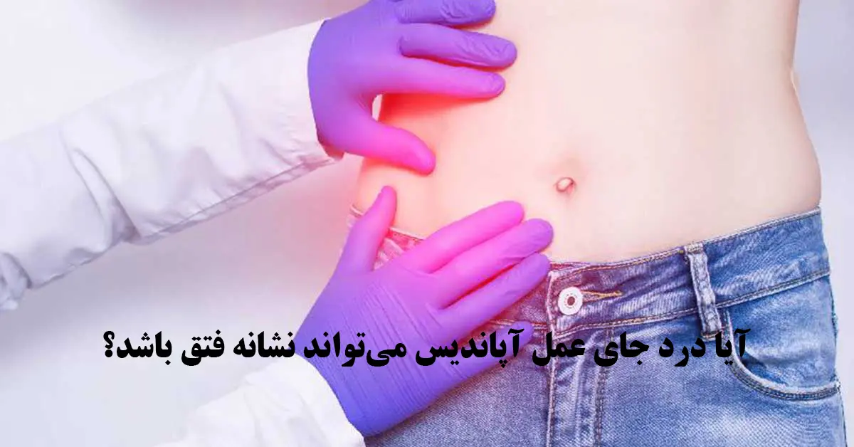 آیا درد جای عمل آپاندیس می‌تواند نشانه فتق باشد؟