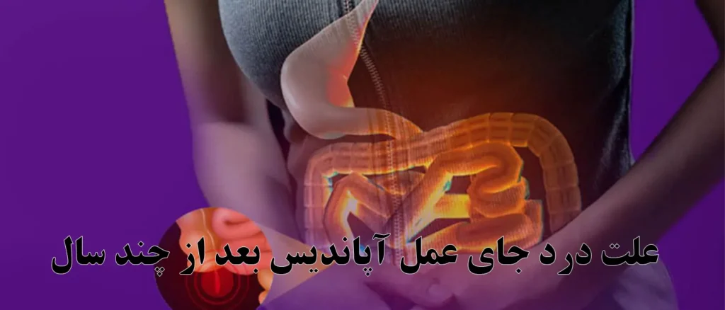 علت درد جای عمل آپاندیس بعد از چند سال | چه زمانی نیاز به بررسی جراح دارد؟