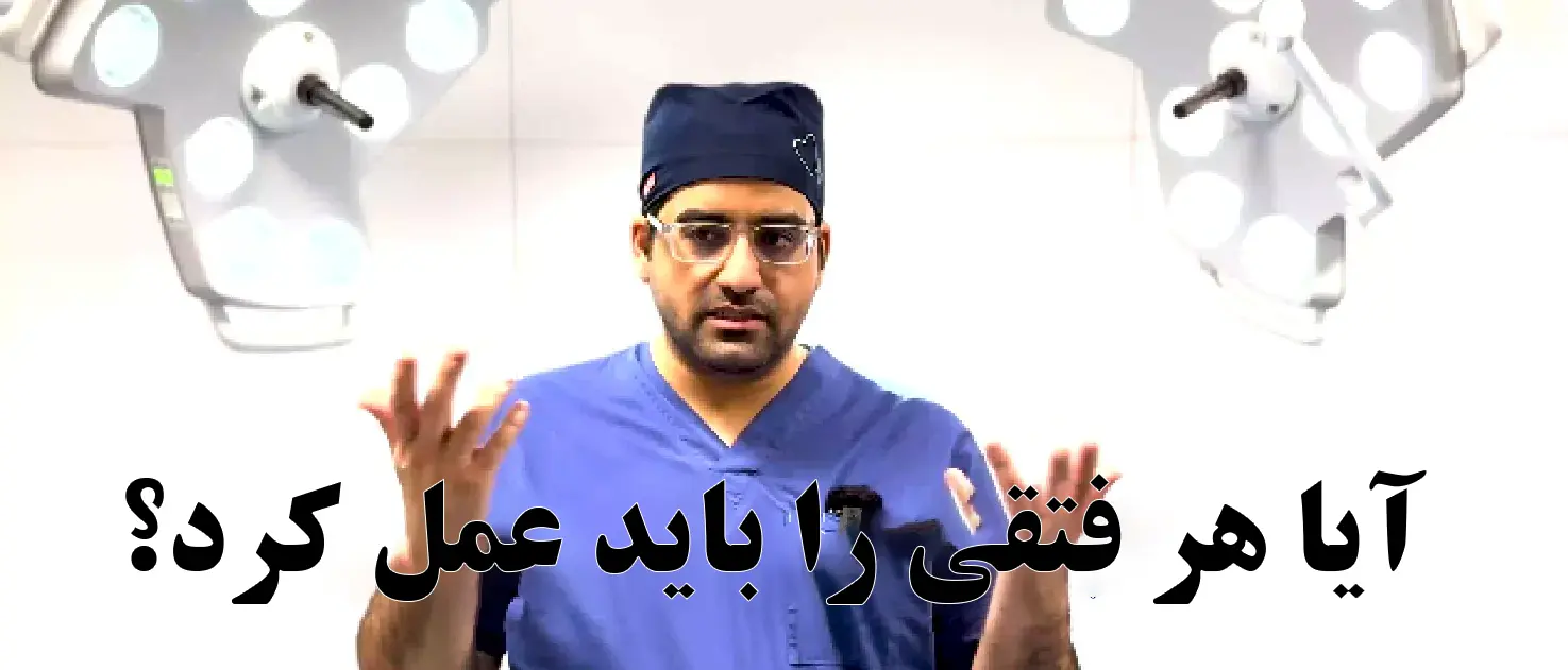 آیا هر نوع فتقی نیازمند عمل جراحی است؟