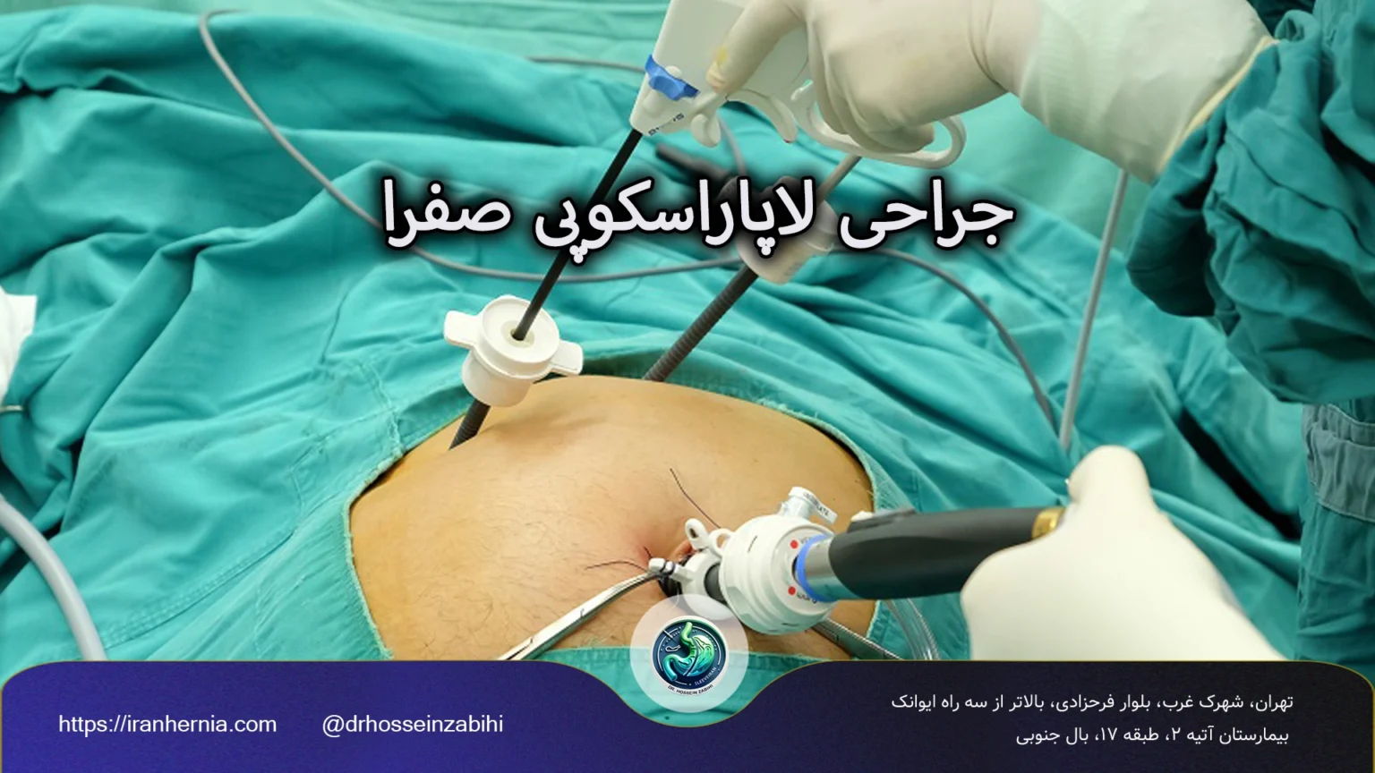 جراحی لاپاراسکوپی کیسه صفرا