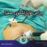 جراحی لاپاراسکوپی کیسه صفرا
