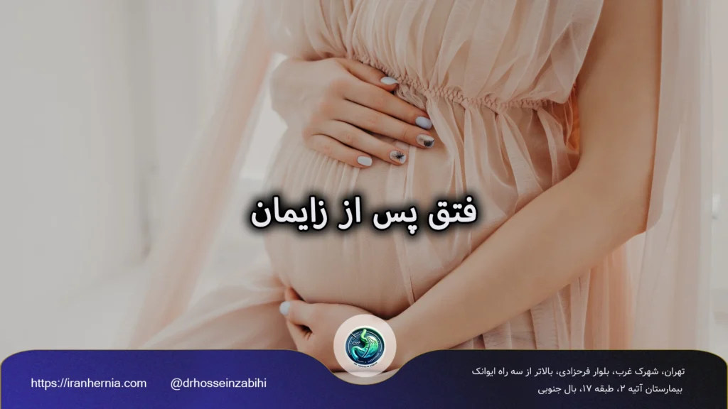 فتق بعد از زایمان